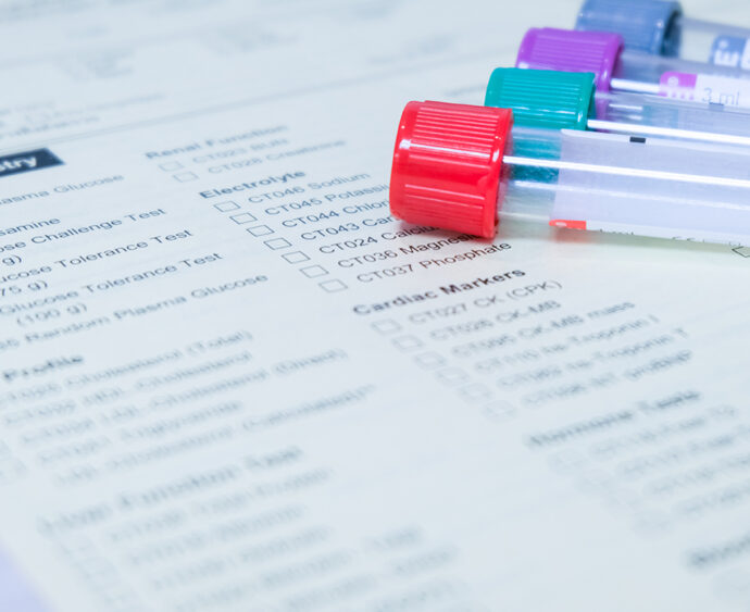 Laboratory tube blood tests